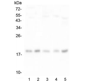 Anti-Interferon gamma / IFNG