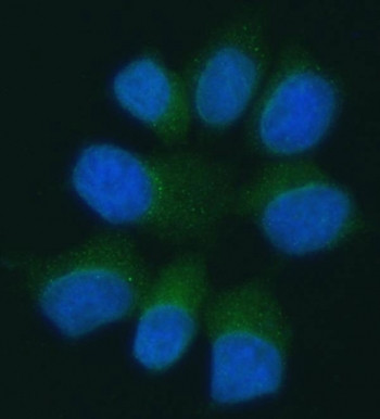 Anti-PANX1 / Pannexin 1
