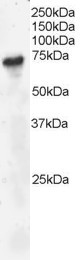 Anti-BLNK / SLP-65, C-terminal