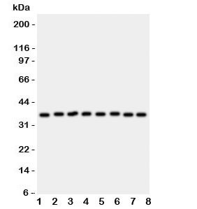 Anti-Annexin V