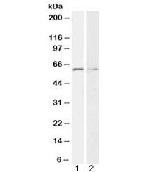 Anti-Glypican-1 / GPC1