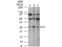 Anti-SIRT5