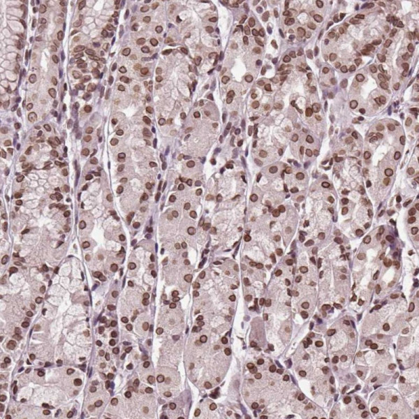 Anti-TTC39C