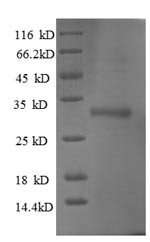 Ubiquitin-conjugating enzyme E2 W (UBE2W), human, recombinant