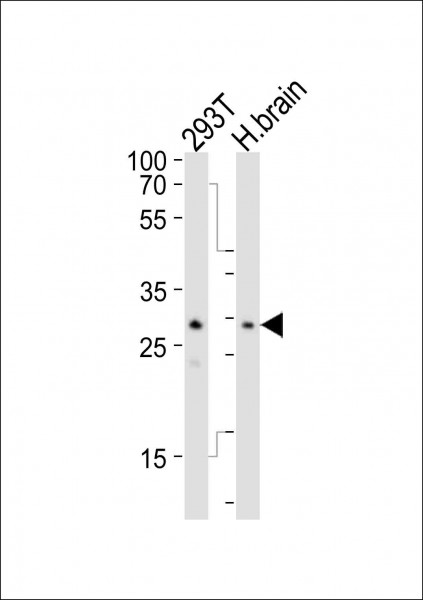Anti-Ribonuclease T2