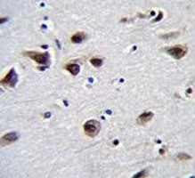 Anti-MeCP2