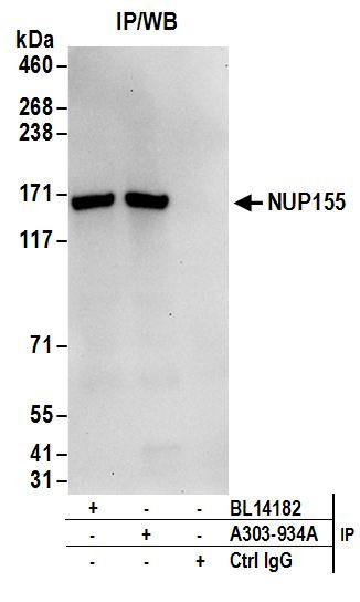 Anti-NUP155
