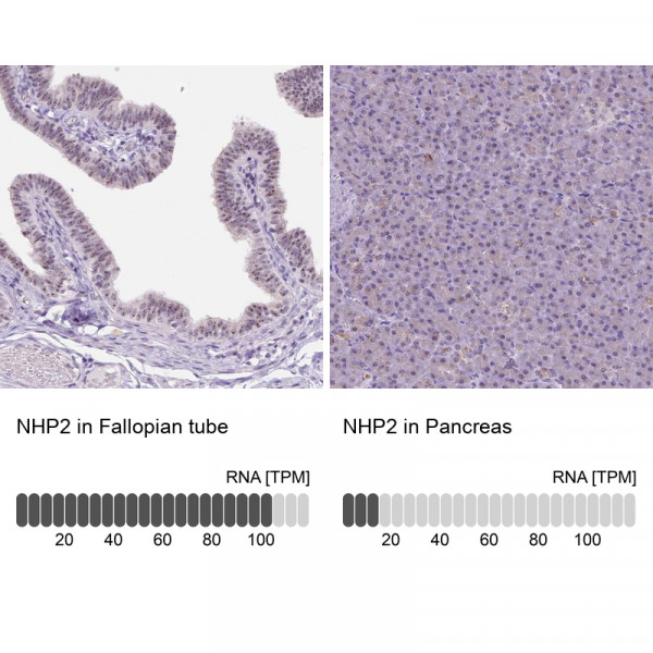 Anti-NHP2