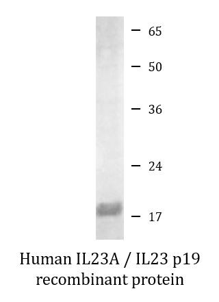 Human IL23A / IL23 p19 recombinant protein (Active)
