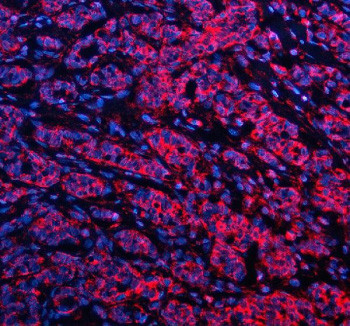 Anti-GSTK1 / Glutathione S-transferase kappa 1