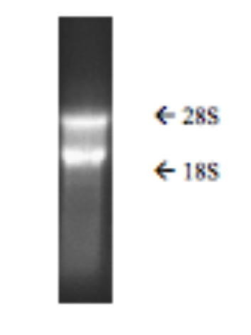 Tissue, Total RNA, Human Adult Normal, Brain