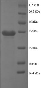 Platelet basic protein (PPBP), partial, human, recombinant