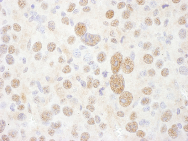 Anti-PSMC2