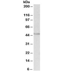 Anti-IDH1