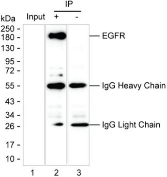 Anti-EGFR