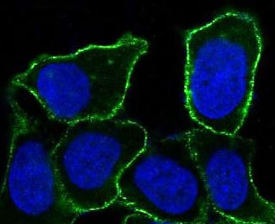 Anti-Integrin alpha 5