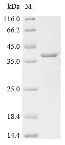 CD81 antigen (Cd81), partial, recombinant mouse
