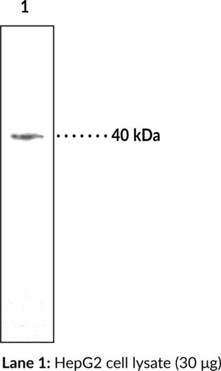 Anti-LPA3