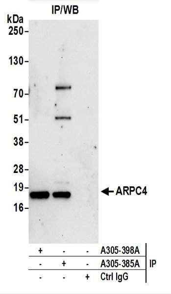 Anti-ARPC4