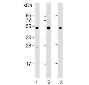Anti-NPTX1 / Neuronal pentraxin 1