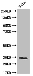 Anti-NUDT5 Recombinant Monoclonal, clone 10D2