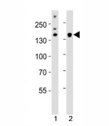 Anti-Kdm6b