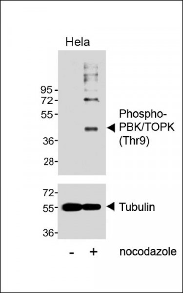 Anti-phospho-PBK / TOPK (Thr9)