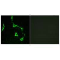 Anti-CDH10