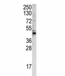 Anti-WNT4