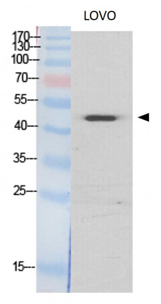 Anti-SLC16A3