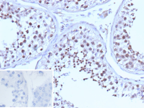 Anti-BRCA1 (Breast Marker), recombinant antibody, clone BRCA1/13502R