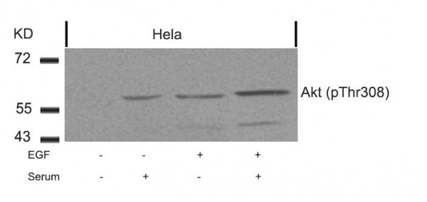 Anti-phospho-Akt (Thr308)