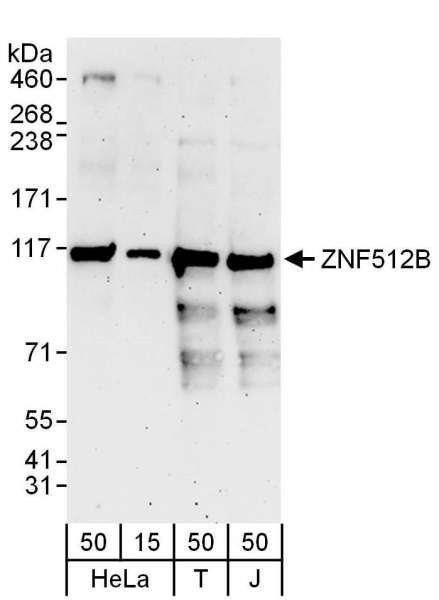 Anti-ZNF512B