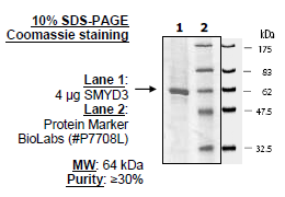 SMYD3 (35-end), active human recombinant protein