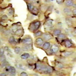 Anti-MUC16/CA125, clone X325