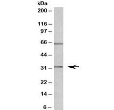 Anti-Caspase 3