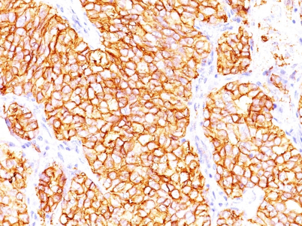 Anti-Renal Cell Carcinoma (Carbonic Anhydrase IX), clone 66.4.C2, same as PN-15
