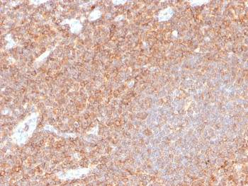 Anti-CD44 / HCAM, clone HCAM/4110R