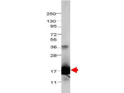 Anti-Interleukin-1F5