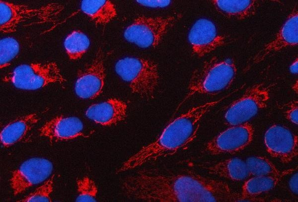 Anti-PYCR1