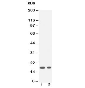 Anti-IL1 beta