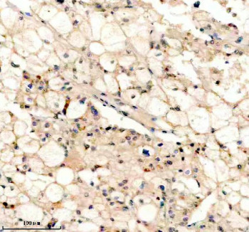 Anti-PEX5 / Peroxisomal biogenesis factor 5