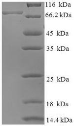BAG family molecular chaperone regulator 3 (Bag3), mouse, recombinant