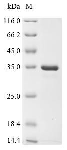 Beta-crystallin B3 (CRYBB3), human, recombinant