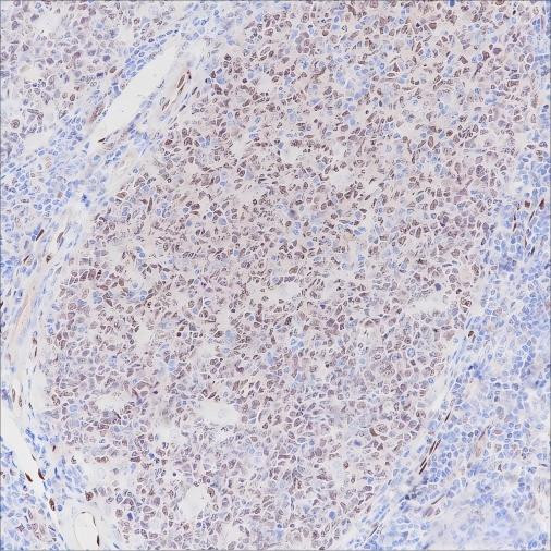 Anti-Recombinant LMO2, clone A286