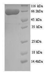 Twinkle protein, mitochondrial (PEO1), human, recombinant