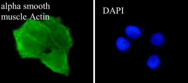 Anti-alpha smooth muscle Actin, clone SQab1735