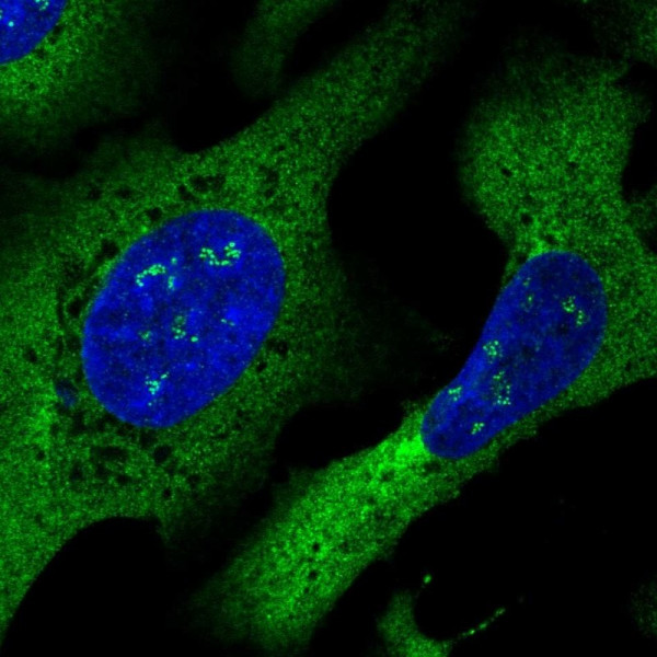 Anti-DYNC1I2