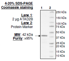 ATAD2B (953-1080), GST-tag, human recombinant protein