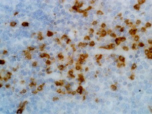 Anti-Kappa Light Chain (human), Rabbit Monoclonal (RM126)